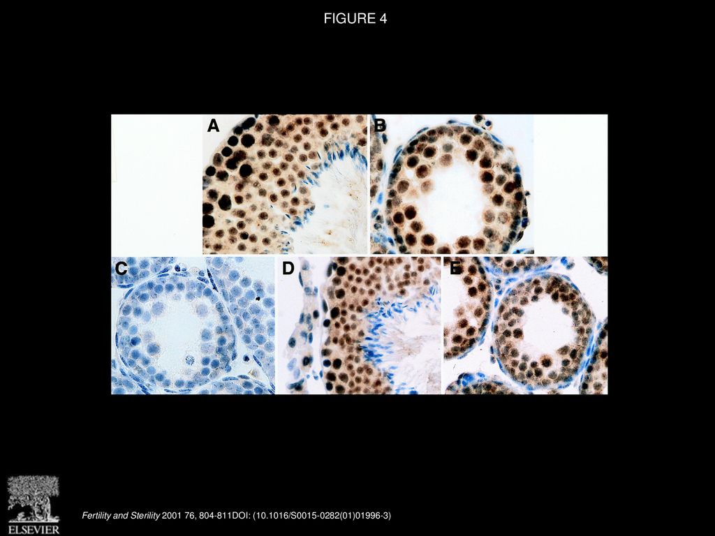 Characterization Of D1Pas1 A Mouse Autosomal Homologue Of The Human